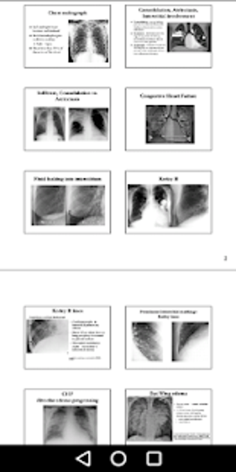 Image 1 for X-Ray -Medical XRay Inter…