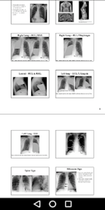 Image 2 for X-Ray -Medical XRay Inter…