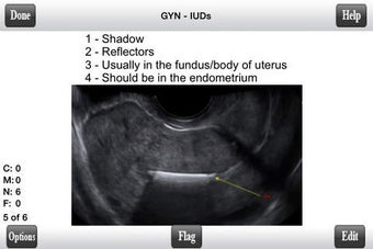 Image 0 for ARDMS Ultrasound Flashcar…