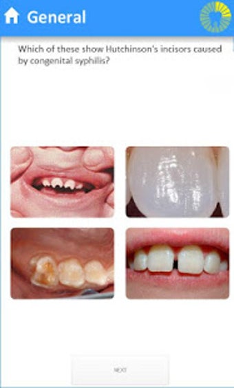 Image 3 for Dentoblast - Dentistry Qu…