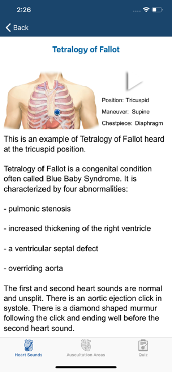 Image 0 for Heart Sounds Auscultation