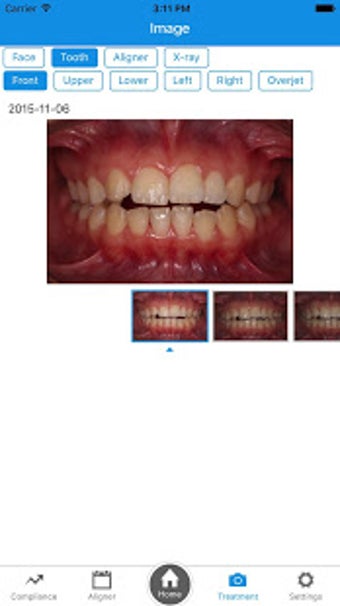 Image 3 for OrthoComm Aligner Managem…