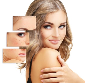 Imagen 0 para Beauty Makeup & Live Self…