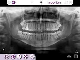 Image 0 for Hyperion X9 Remote Panel