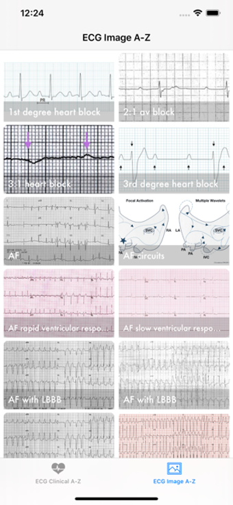 Image 1 for ECG A-Z Pro