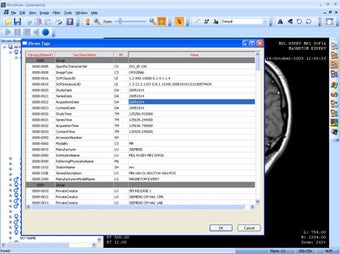 Imagen 0 para MicroDicom