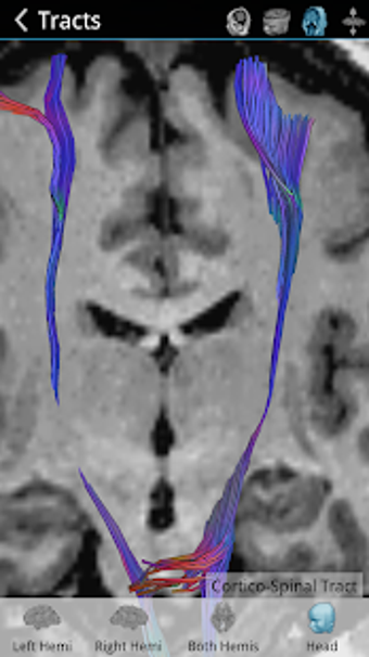 Imagen 3 para Brain Tutor 3D