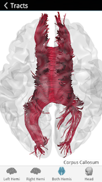 Imagen 1 para Brain Tutor 3D