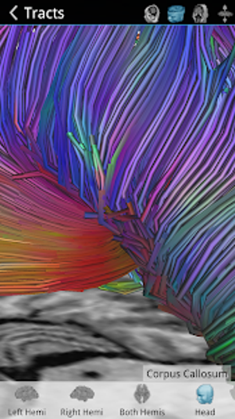 Imagen 2 para Brain Tutor 3D