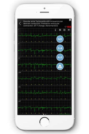 Image 0 for ECG - Cases, Exams, Quizz…