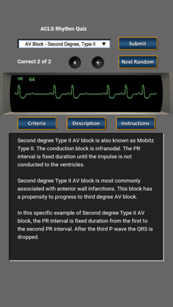 Image 1 for ACLS Rhythm Quiz