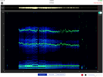 Image 2 for Voiceprint - Estill Voice…