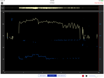 Image 0 for Voiceprint - Estill Voice…