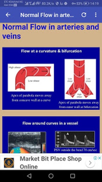 Imagen 1 para Doppler Ultrasound