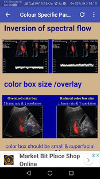 Imagen 2 para Doppler Ultrasound
