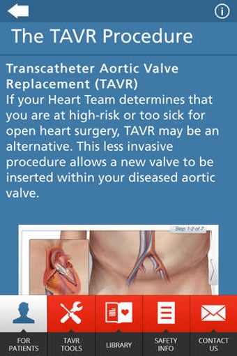 Imagen 0 para Edwards TAVR