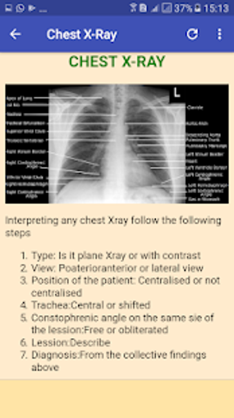 Imagen 1 para X Ray Chest Urinary Bone …