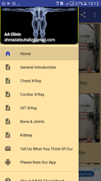 Imagen 2 para X Ray Chest Urinary Bone …