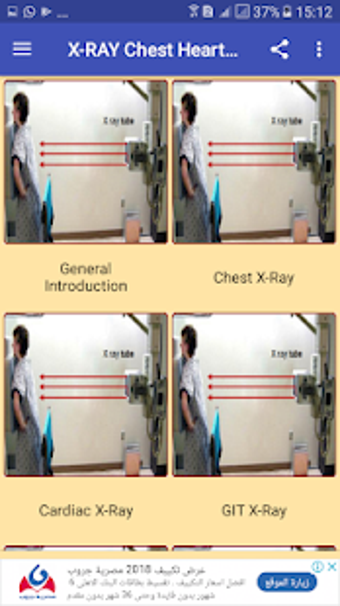Imagen 0 para X Ray Chest Urinary Bone …