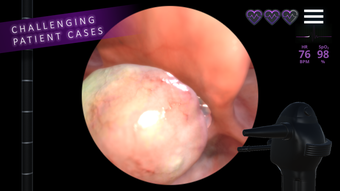 Image 1 for Airway Ex - Intubate. Ane…