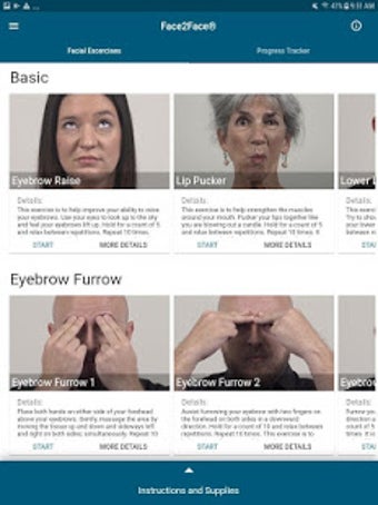 Imagen 2 para Face2Face Facial Palsy