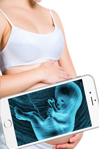 Image 0 for Ultrasound Scanner (Prank…