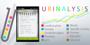 Imagen 1 para Urinox