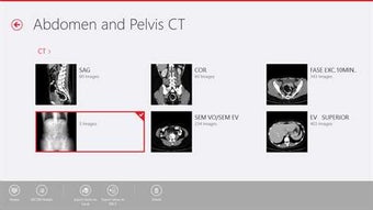 Image 1 for Navegatium DICOM Viewer f…
