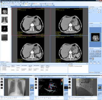 Image 0 for Sante DICOM Viewer CDR