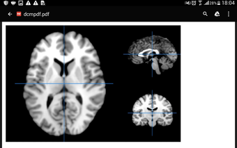 Image 2 for Dicom Medical Image Viewe…