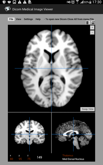 Image 1 for Dicom Medical Image Viewe…