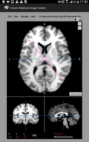 Image 3 for Dicom Medical Image Viewe…
