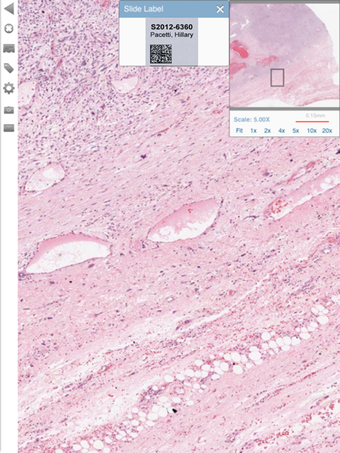 Image 1 for Aperio ePathViewer for iP…