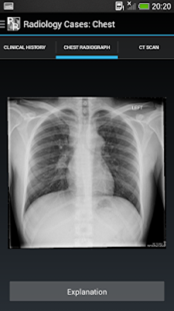 Image 3 for Radiology Cases: Chest