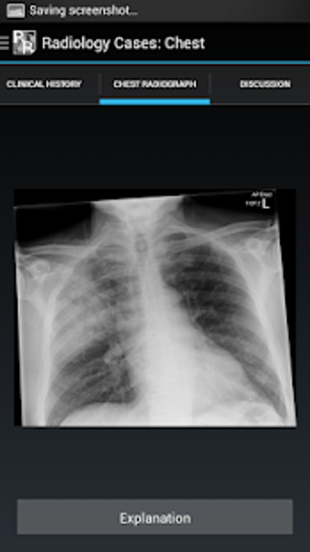Image 1 for Radiology Cases: Chest