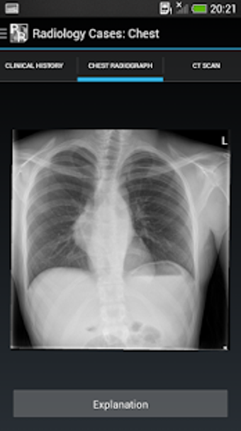 Image 2 for Radiology Cases: Chest