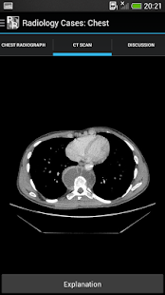 Image 0 for Radiology Cases: Chest