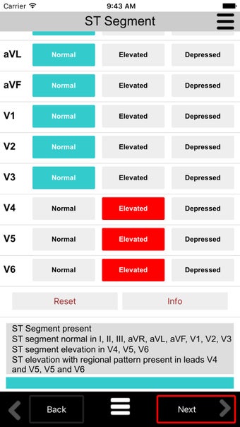 Image 1 for Ecg Calc