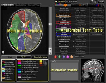 Image 0 for CT and MRI Interactive At…