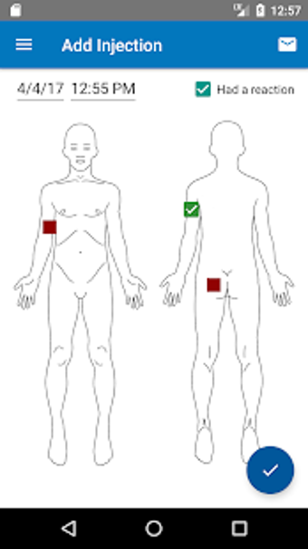 Imagen 2 para Injection Tracker
