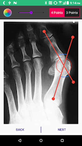 Imagen 3 para Angulus: Measure angles o…