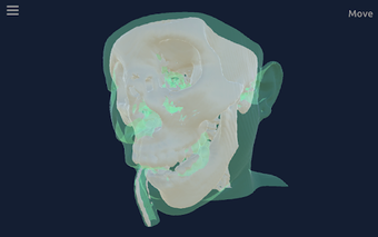 Image 2 for CT Scan Viewer 3D