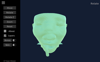 Image 0 for CT Scan Viewer 3D