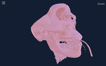 Image 1 for CT Scan Viewer 3D