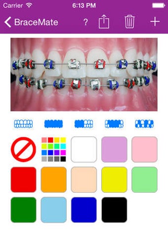 Image 0 for BraceMate