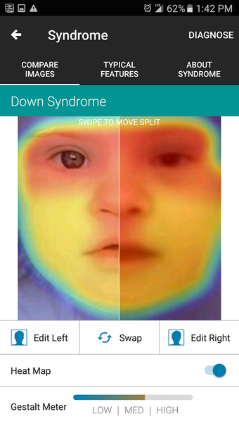 Imagen 3 para Face2Gene