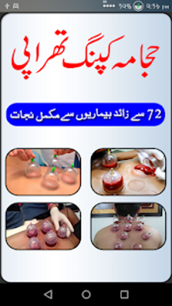 Image 0 for Hijama Cupping Tutorials