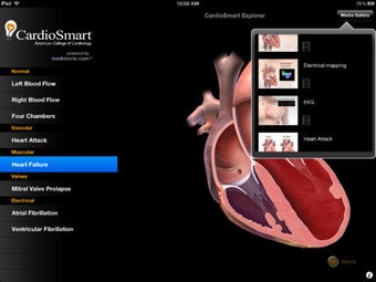 Image 0 for CardioSmart Heart Explore…