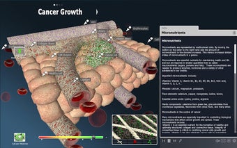 Image 0 for bodyxq cancer