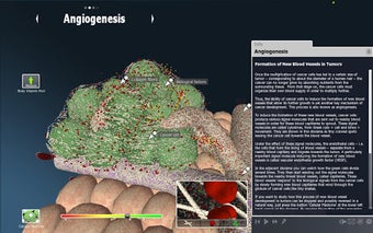 Image 2 for bodyxq cancer